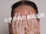 缲ķ